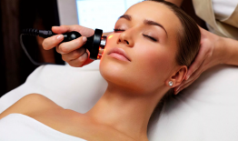 RF-лифтинг лица